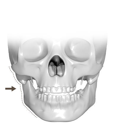 345 Plastic Surgery skull showing natural jawline contouring. Plastic surgery where natural.