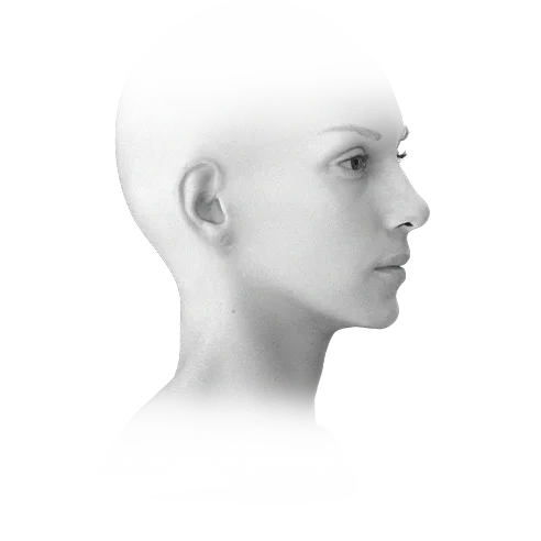 Woman's profile for 345 plastic surgery. Natural results.