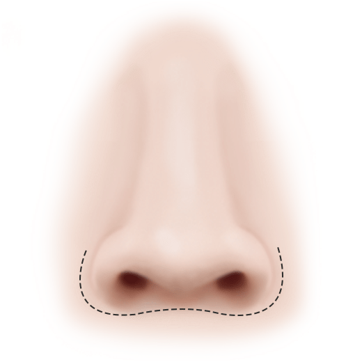 Nose contouring for 345 plastic surgery where natural looking results are achieved.