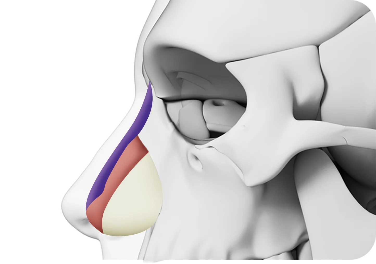 Rhinoplasty 345 Plastic Surgery diagram showing natural nose reshaping.