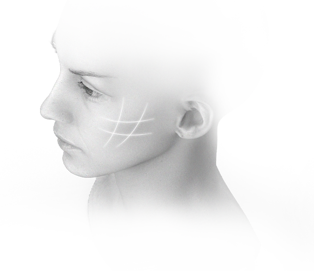 Woman's face with grid lines for 345 plastic surgery where natural.