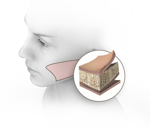 345 Plastic Surgery for natural results. Face with skin and bone layers.