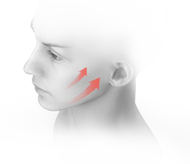 Plastic surgery face lift with arrows showing natural results. 345 Plastic Surgery where natural.