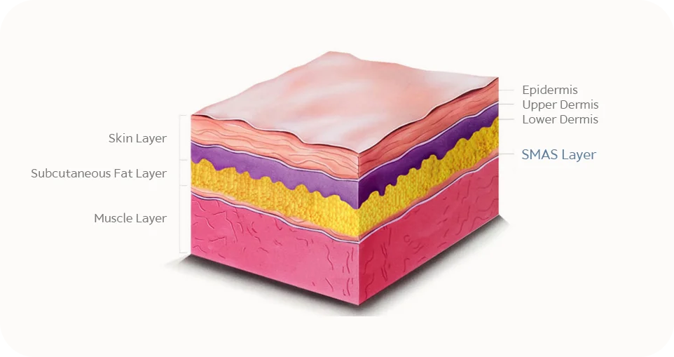 Skin layers diagram showing epidermis dermis fat muscle for 345 plastic surgery where natural