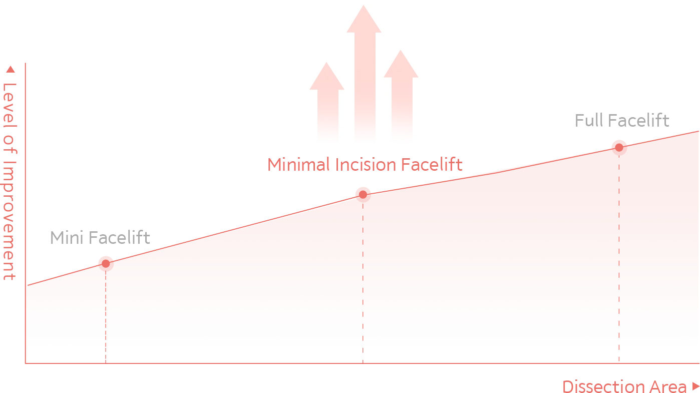 Facelift plastic surgery chart showing mini minimal incision and full facelift results. 345 Plastic Surgery where natural.
