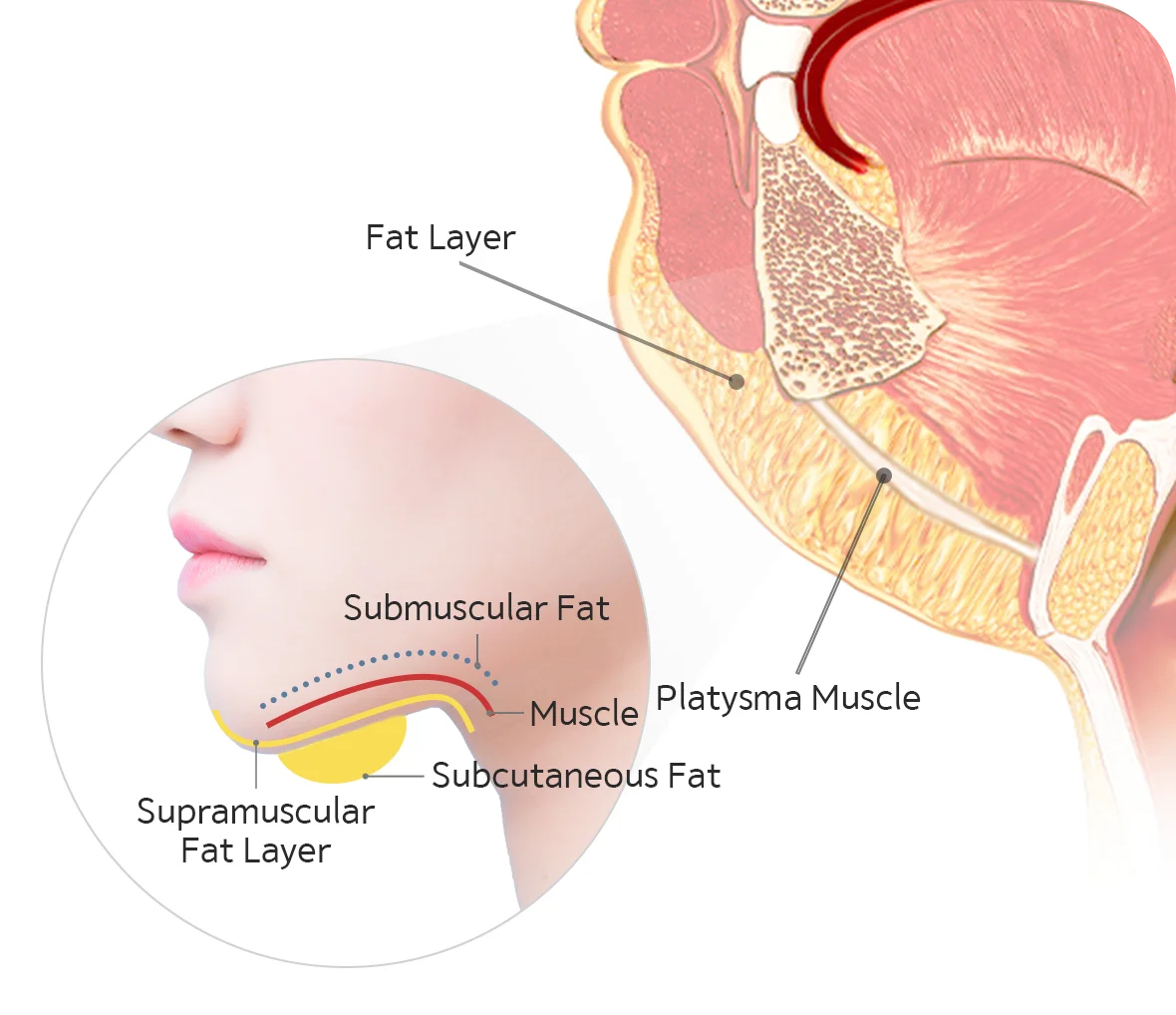 Plastic surgery diagram showing fat layers and muscles for 345 Plastic Surgery where natural