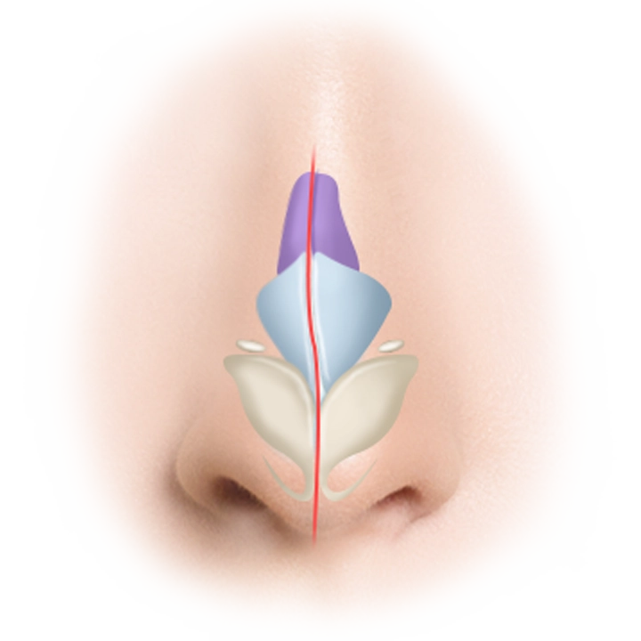 Nose anatomy for 345 Plastic Surgery where natural, diagram of nasal structure.