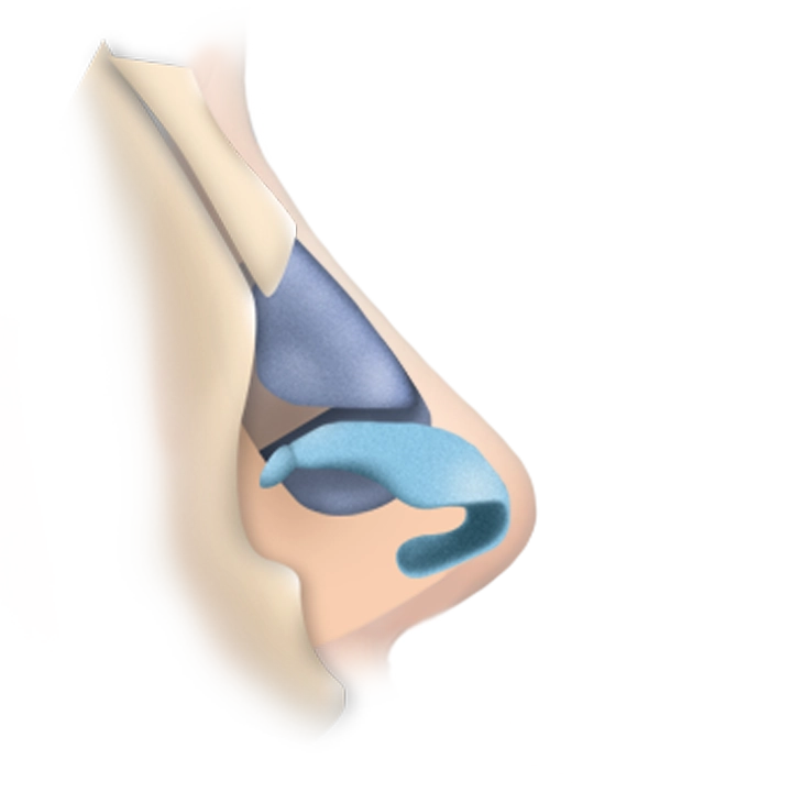 Nasal anatomy illustration for 345 plastic surgery where natural results are desired.