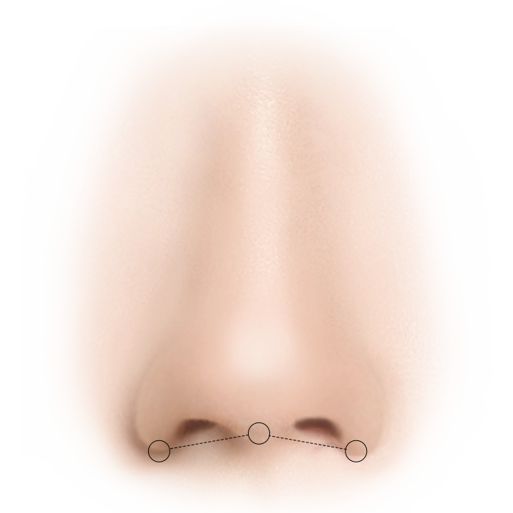 Nose with markings for 345 plastic surgery where natural rhinoplasty procedure.